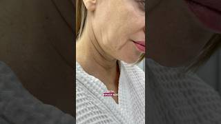 Много косметологии в лице 💉 Доктор НИКОЛАЕВА