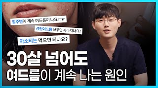 성인 여드름은 왜 계속 날까? (Feat. 여드름 없애는 방법, 입주변 여드름 원인)