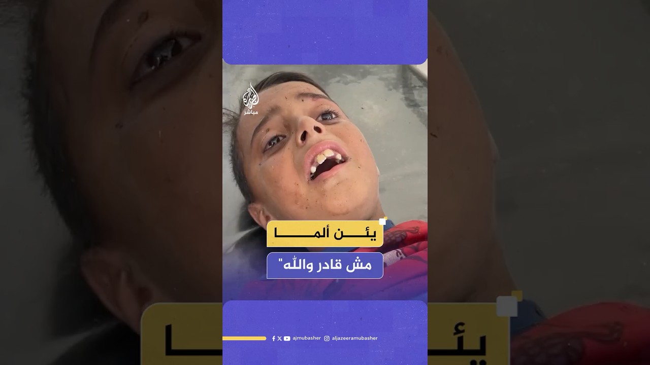 أنس طفل غزاوي يئن ألما بسبب جروحه التي أصيب بها جراء قصف إسرائيلي استهدف خيمة نزوحه هو وعائلته