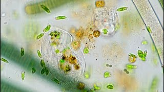 Freshwater Hypotrich - Possibly Euplotes