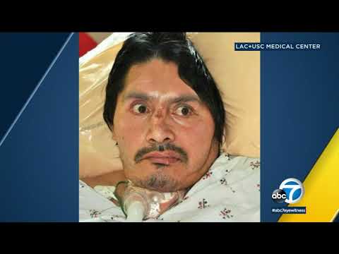 LAC+USC Medical Center seeking to identify patient | ABC7