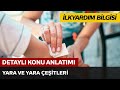 İlkyardım Bilgisi / Yara ve Yara Çeşitleri