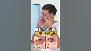 Removing UNDER EYE BAGS 🔥 #osteopathy #undereyebags #wrinkles #facefitness #faceyoga #skincare