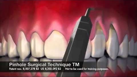 Dental Excellence - Pinhole Animation