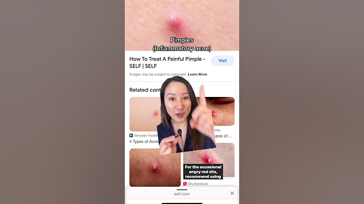 How to Treat Different Types of Acne #shorts