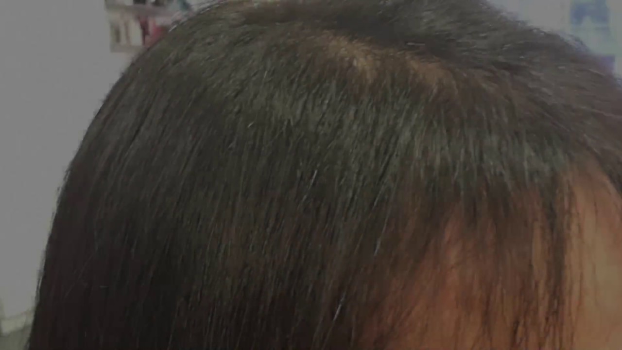 VIDAHAIR TRIMMER TECHNOLOGY