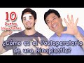 ¿Cómo es el Postoperatorio de una Rinoplastía?