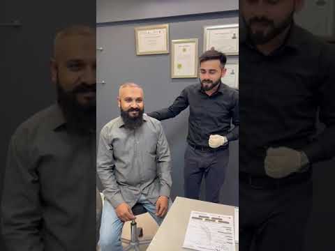 Fue Hair Transplant - Satisfied Patient!  #hairtransplant #hairstyle #hair #shortsfeed #shorts #yt