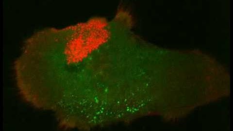 Time-Lapse: HIV-1 Infected Human Macrophage by Mr. Raphael Gaudin