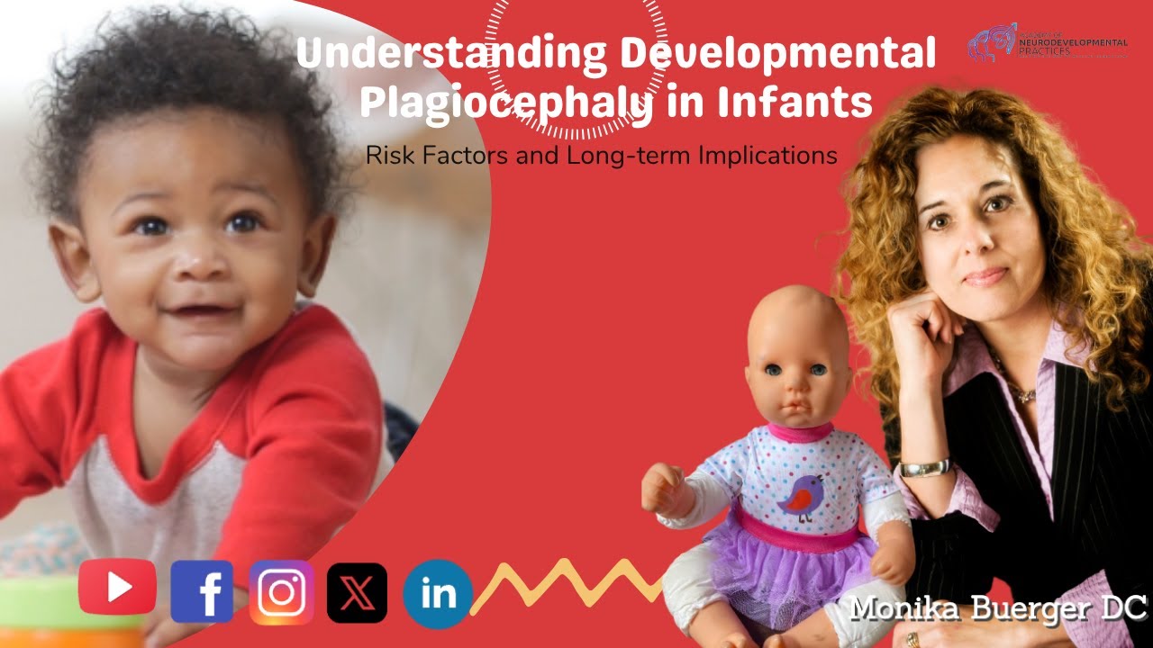 Understanding Developmental Plagiocephaly in Infants: Risk Factors and Long-term Implications