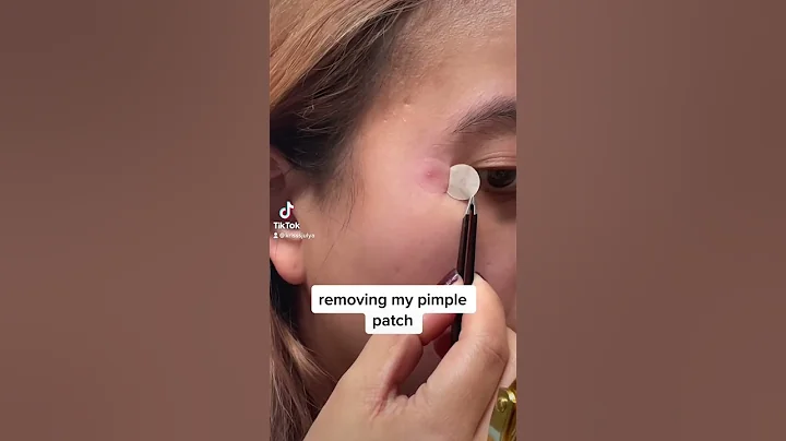 removing my pimple patch. it’s not as nasty tho :( #pimpleremoval #shorts