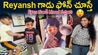 REYANSH గాడు  PHONE చుస్తే కన్లలా నుండి  BL**d వచ్చింది | KUYYA VLOGS