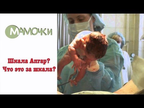 Шкала Апгар. Что это за шкала?