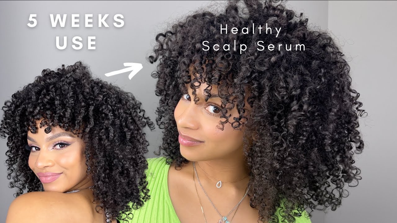 1 Month Results with New OIL FREE Scalp Serum LUS Brands YouTube