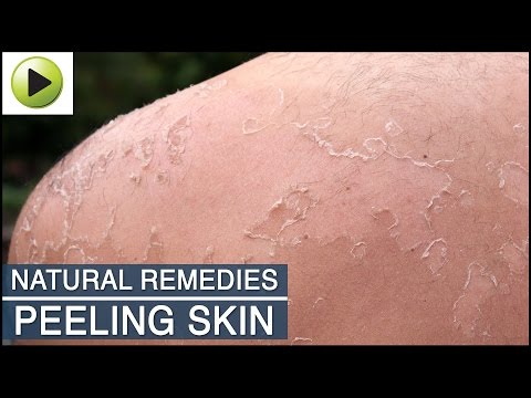 Skin Care - Peeling Skin - Natural Ayurvedic Home Remedies