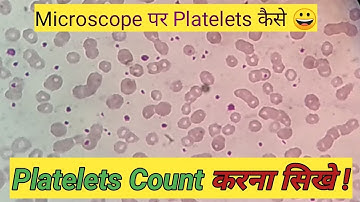 Manual platelet count slide method | Platelets count on smear