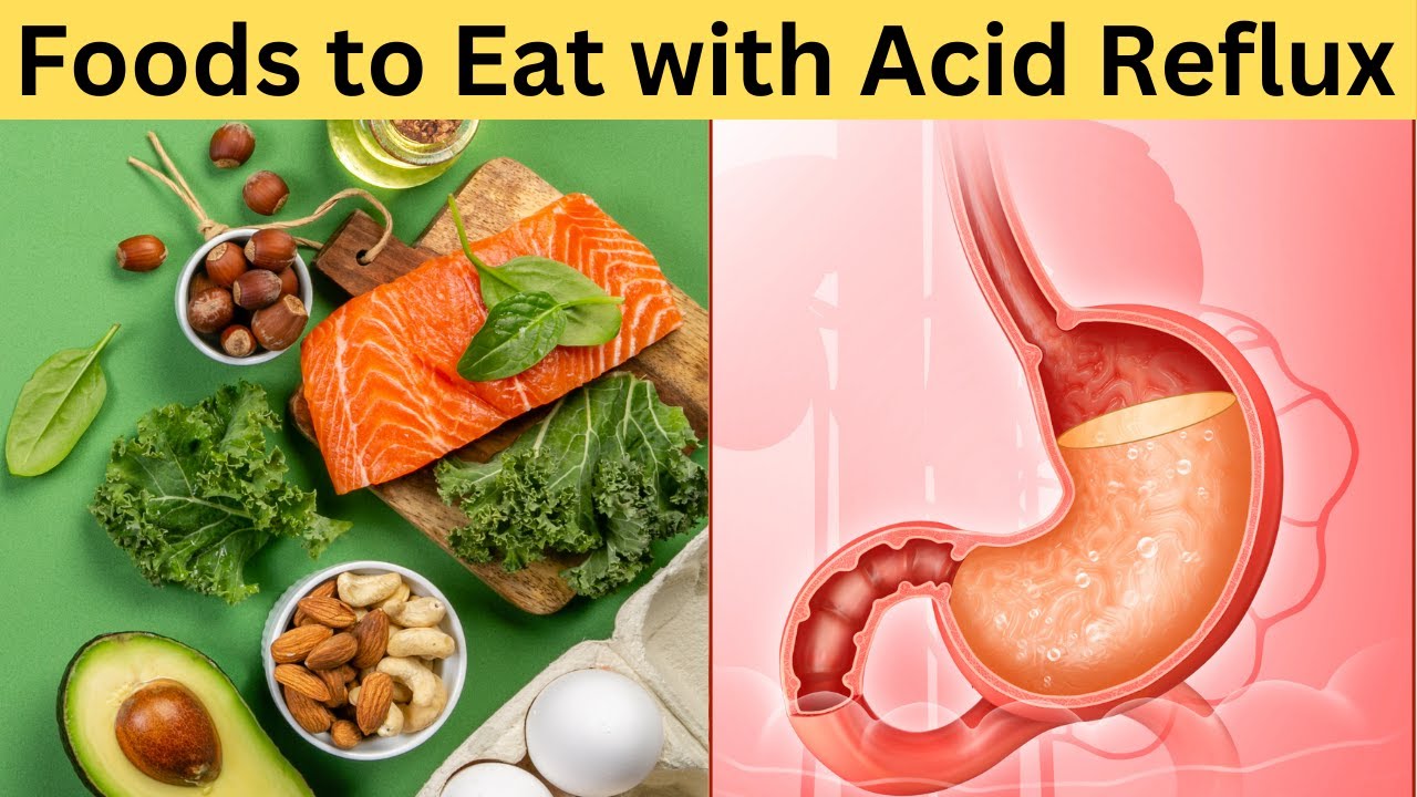 10 Best Foods for Acid Reflux, Diet for acid reflux Foods for acidity