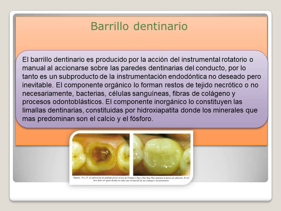 Para que sirve el hipoclorito de sodio en endodoncia