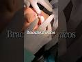 #viral #ortodoncia #bracket #dentista #tiktok #invisalign #sonrisa #dientes #fyp #foryou #reels