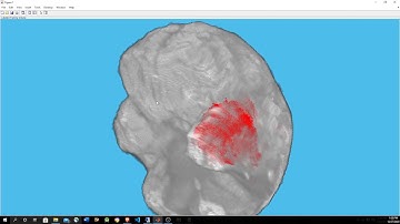 Using MATLAB and deep learning to detect tumors in MRI images of brains