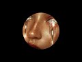 M.O Collette,Dosdu - LOBA (Official Audio)