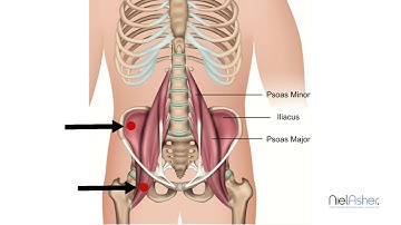 Psoas Muscles - How To Find Trigger Points (Back and Groin Pain)