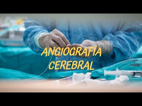ANGIOGRAFIA O ARTERIOGRAFÍA CEREBRAL 🧠 ¿Qué es y cómo se hace una angiografía?