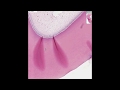 Развитие и гистологическое строение зуба   Odontogenesis  Tooth  Норма