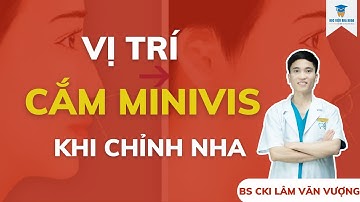 Vị Trí Cắm Mini Vis Khi Chỉnh Nha | Cắm  Vít Chỉnh Nha | Học Viện Nha Khoa
