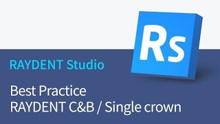 [RAYDENT Studio] 列印單顆牙冠