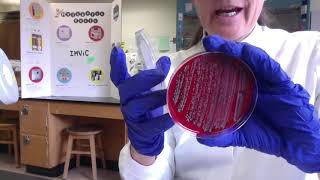 lab movie Ch 10 Blood agar results 3 15 2020
