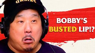 Bobby Lee FALLS ON HIS FACE and Needs Stitches!