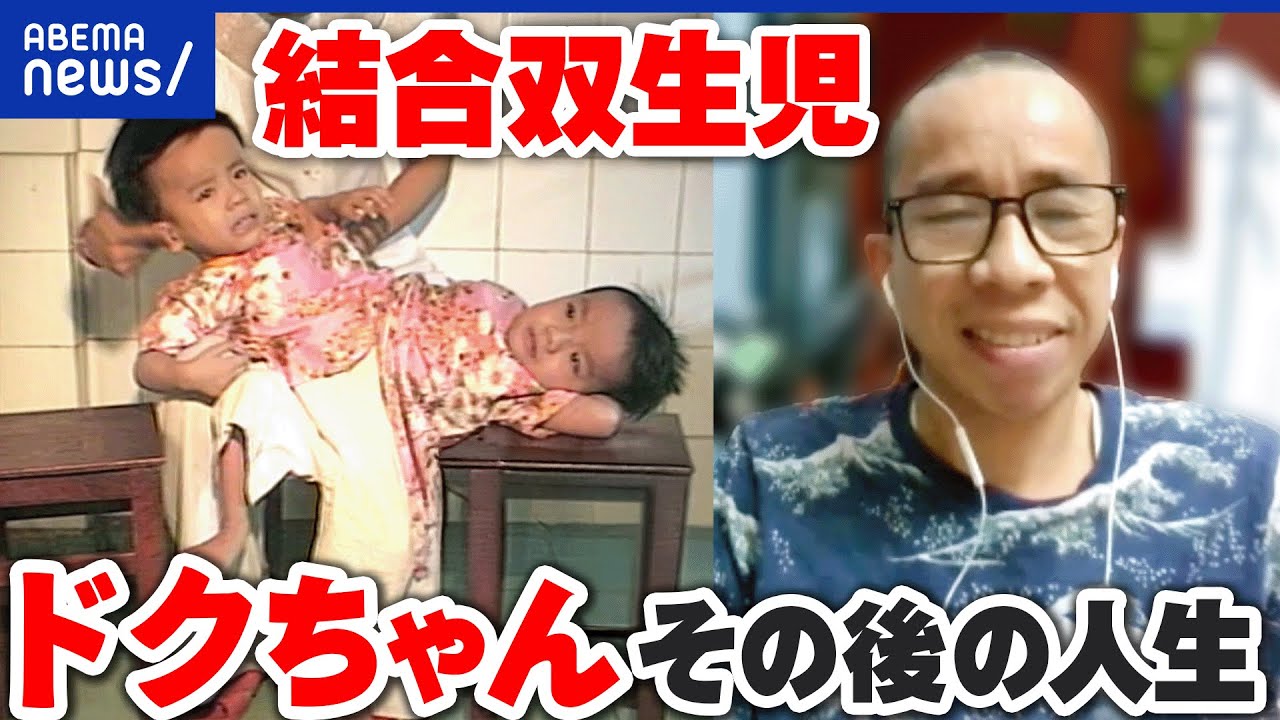 ベト ちゃん ドク ちゃん 現在