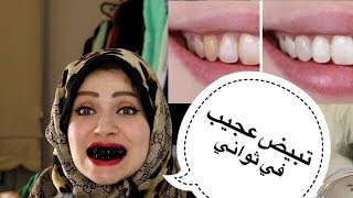 خمس طرق  لتبيض أسنانك بسيطة وسريعة والنتيجة تحدي