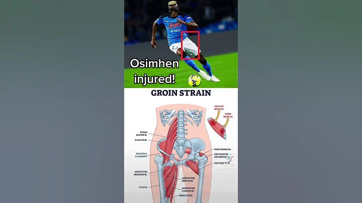 Victor Osimhen injured. Expert explains | #napoli #sscnapoli #victorosimhen #seriea #championsleague