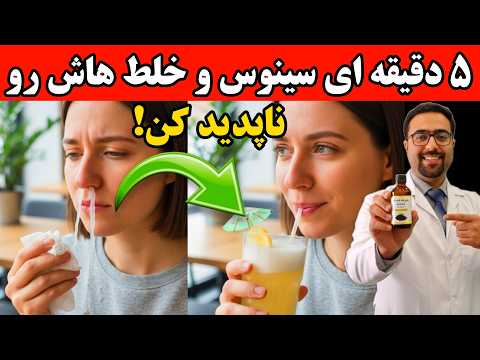 خلط و بلغم رو در ۱۰ دقیقه ذوب کن فرمول دکترها فاش شد