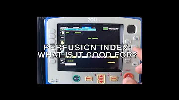What should my perfusion index be?