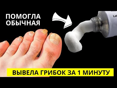 Просто Нанеси Эту ЯДРЁНУЮ Мазь и Она Разъест Весь Грибок с Ногтей! Есть в Каждой Аптеке!