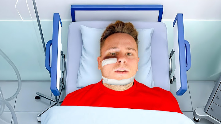 JEDVA SAM PREZIVEO… ovo se desilo 🤕