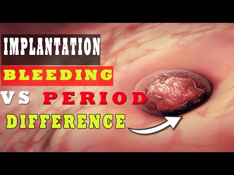 Video: Hvordan Ser Spotting Ud? Menstruation, Implantering, Graviditet