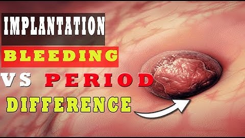 Implantation Bleeding Vs Period – (How to Know the Difference?) 🩸🩸