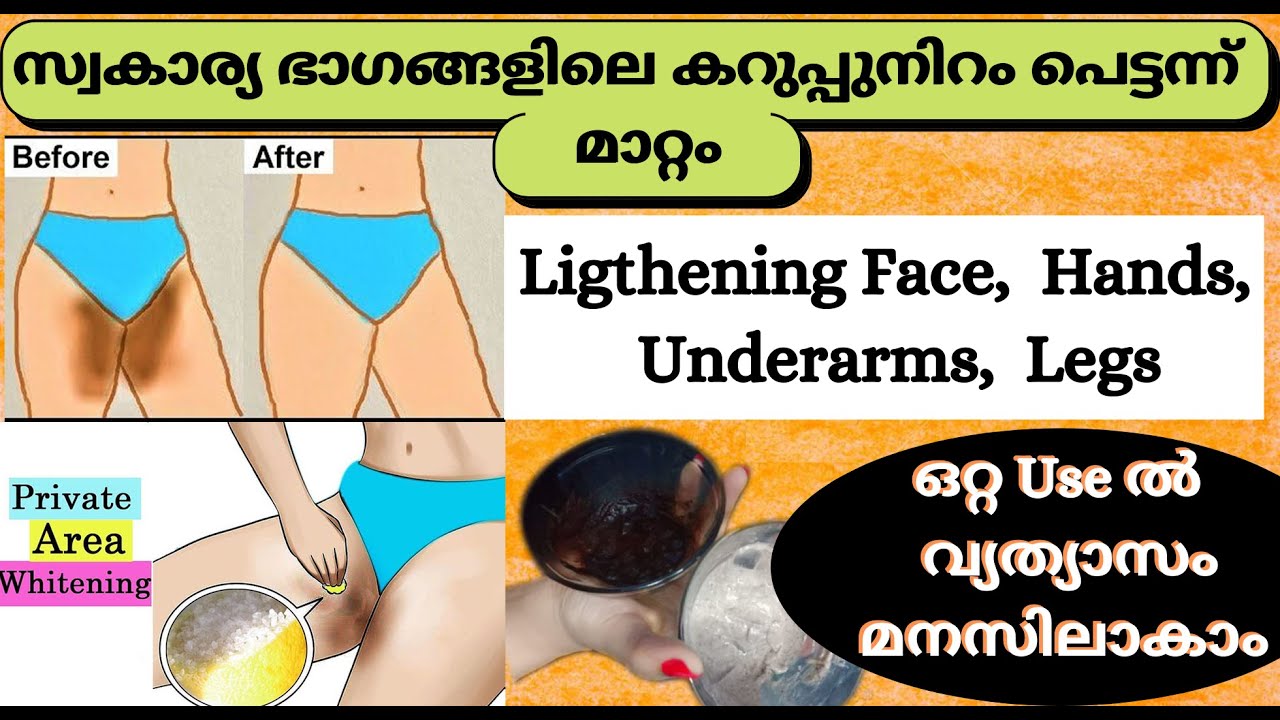 How to Lighten Private areas Naturally at Home ?/Single use difference