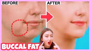 Buccal Fat Removal Exercise | Reduce Cheek Fat, Chubby Cheeks (No Surgery!💕)