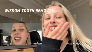 Getting back to health after traveling MINI VLOG + Wisdom tooth removal