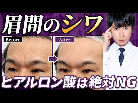 【眉間のシワ】無意識に作っていませんか?深く刻まれる前に知るべき原因とは