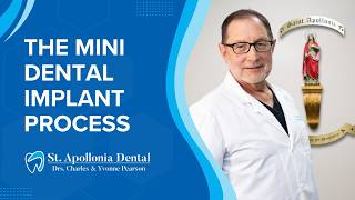 The Mini Dental Implant Process Explained Step by Step | Mini Dental Implants in Sterling Heights MI