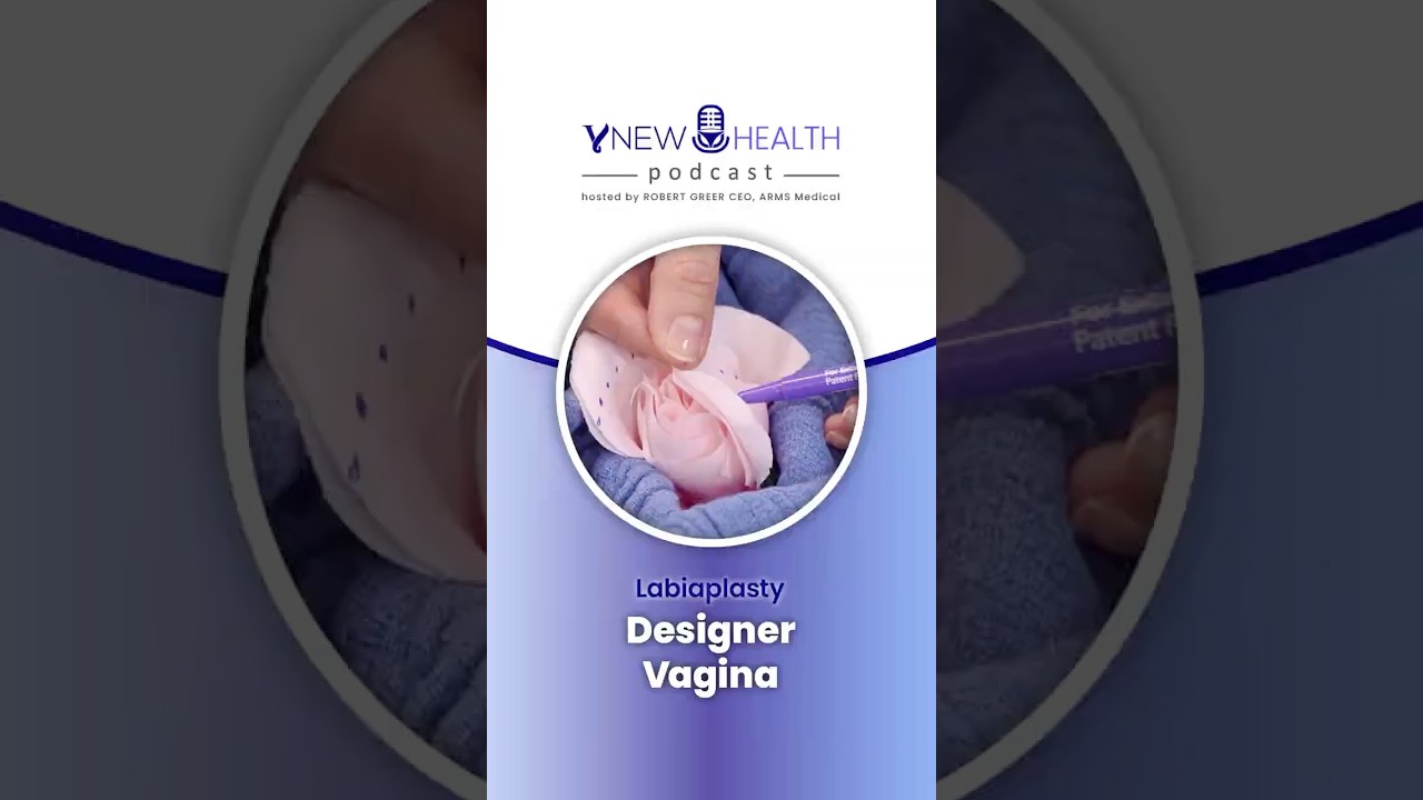 Labiaplasty Designer Vagina
