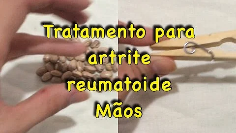 O que é bom para artrite nas mãos?