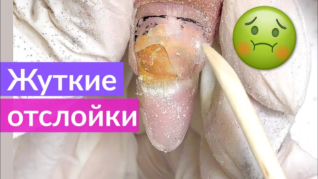 Коррекция Наращенных ногтей | Ужасные Отслойки