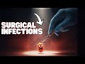 How to Handle Infections After Plastic Surgery - Ask a Plastic Surgeon